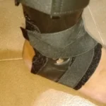 Ankle Support Brace with Side Stabilizers | Adjustable Compression, Shoe-Compatible for Everyday & Sports Use photo review