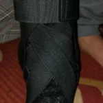 Ankle Support Brace with Side Stabilizers | Adjustable Compression, Shoe-Compatible for Everyday & Sports Use photo review