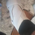 Ankle Support Brace with Side Stabilizers | Adjustable Compression, Shoe-Compatible for Everyday & Sports Use photo review